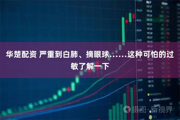 华楚配资 严重到白肺、摘眼球……这种可怕的过敏了解一下